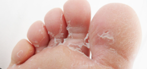 How to Maintain Healthy Feet
